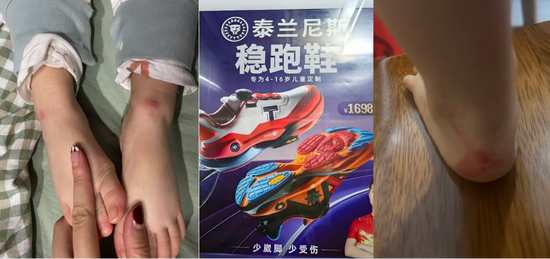 千元童鞋把脚穿肿？泰兰尼斯遭家长“围攻”，医生警惕影响发育，90%专利竟是外观设计  第1张